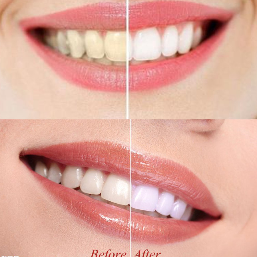 Dientes de carbón de bambú par - Teeth Whitening Remedies reseña y precio