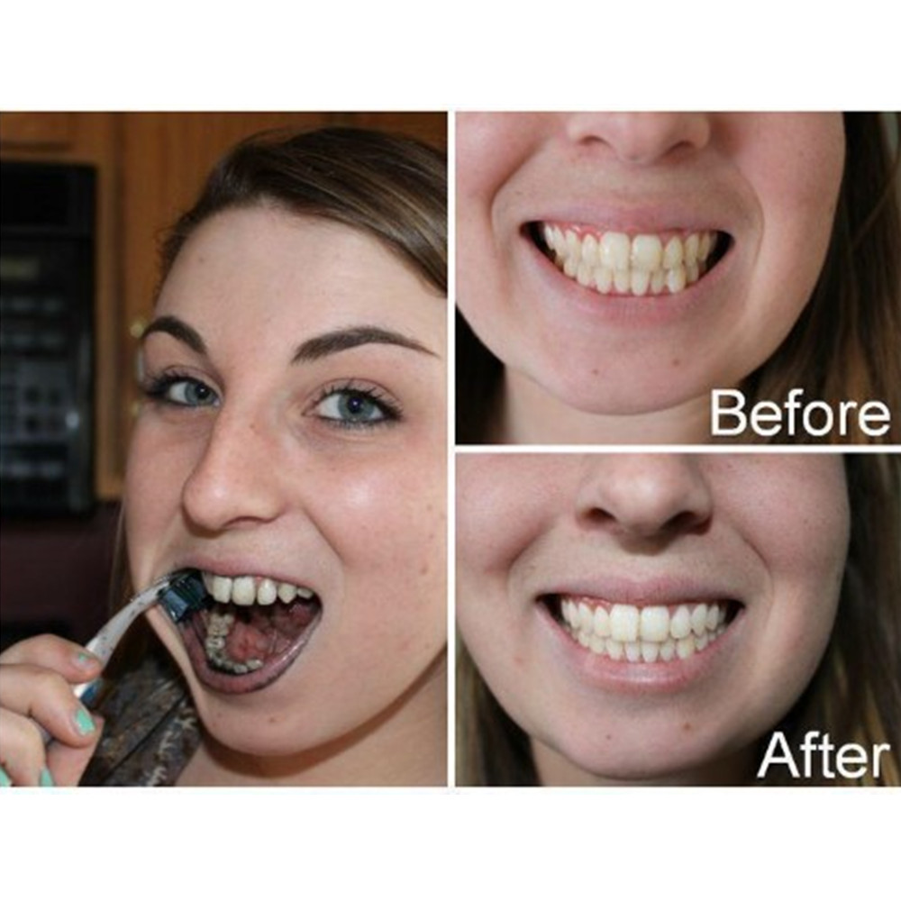Dientes de carbón de bambú par - Teeth Whitening Remedies reseña y precio
