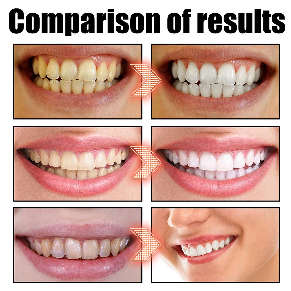 Enjuague Bucal de Coco y Menta - Teeth Whitening Oil Pulling reseña y precio