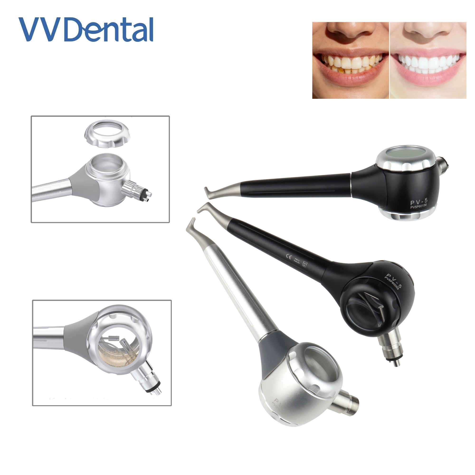 Pistola de arenado dental VV d - Teeth Whitening China reseña y precio