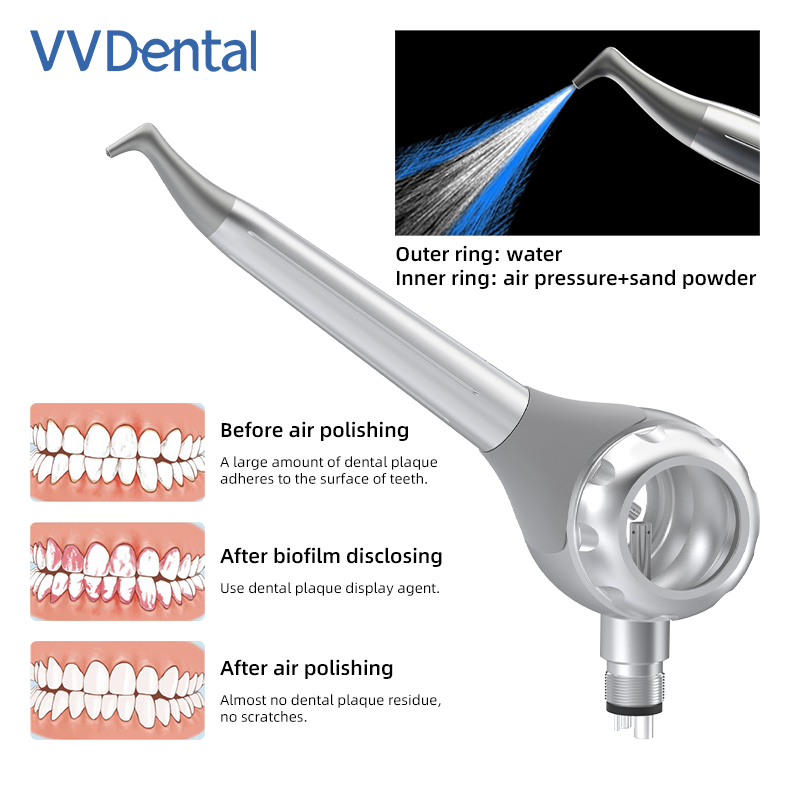Pistola de arenado dental VV d - Teeth Whitening China reseña y precio