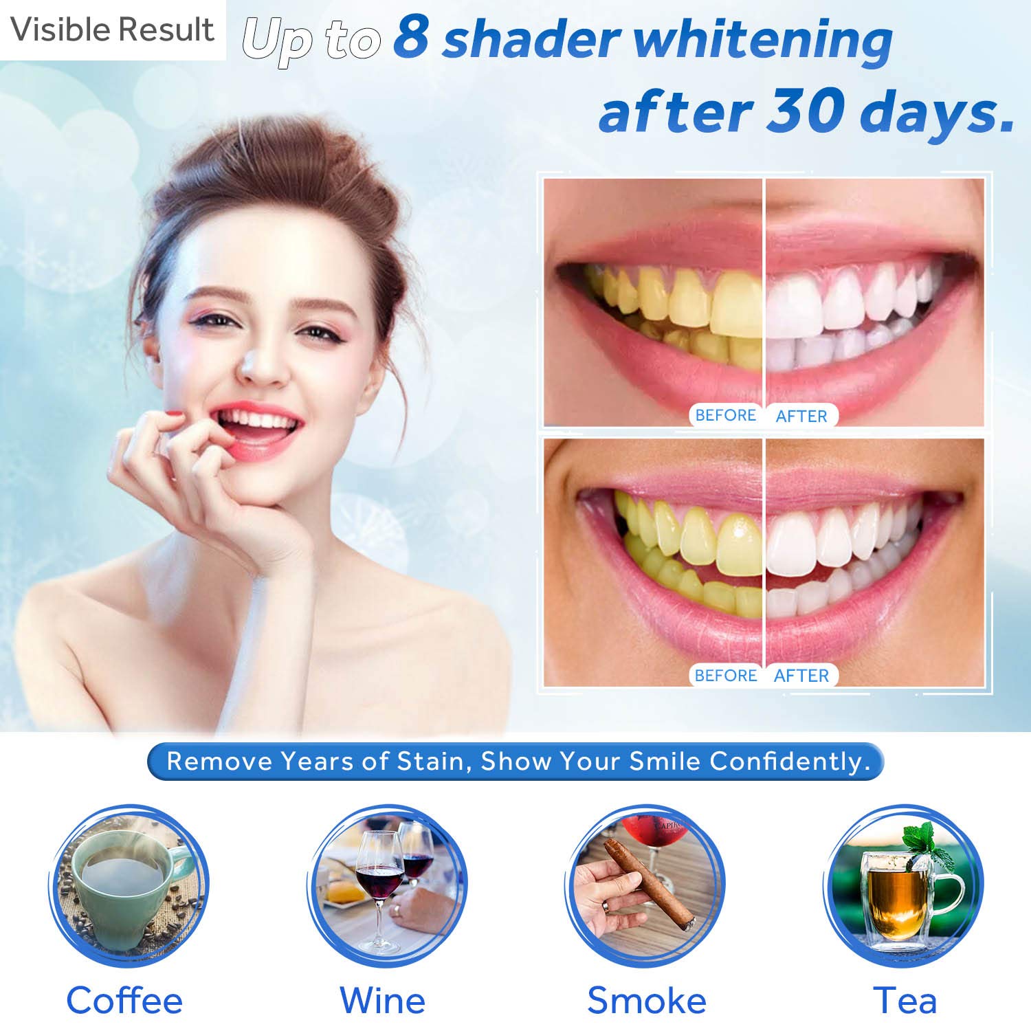 Jeringa de repuesto de Gel par - Teeth Whitening Remedies reseña y precio