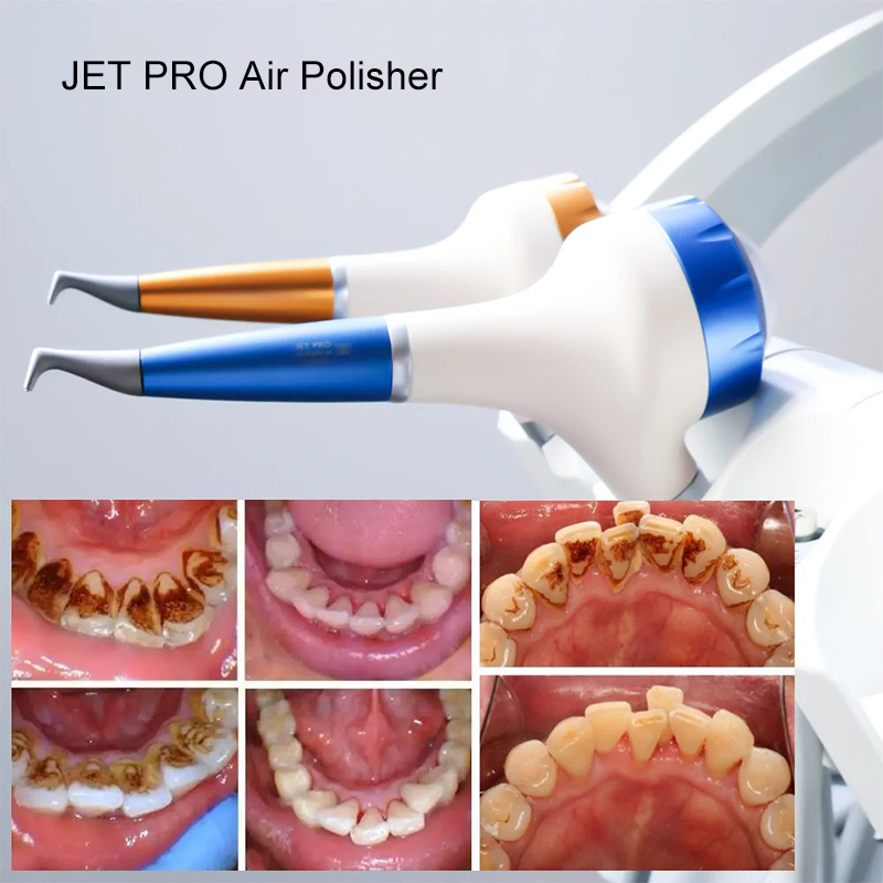 VV Dental Air Polishing Prophy - Teeth Whitening China reseña y precio