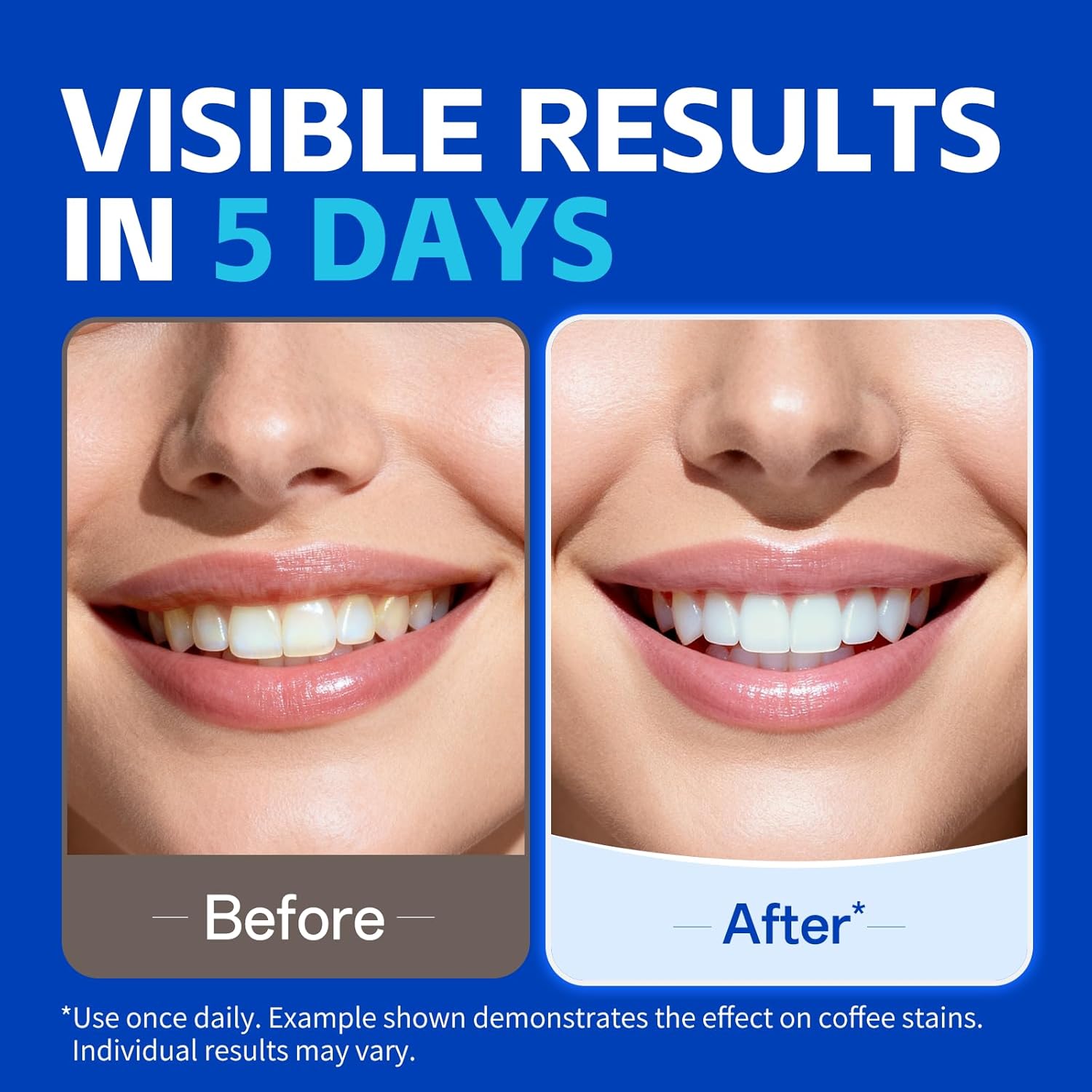 Tiras blanqueadoras de dientes - Teeth Whitening Oil Pulling reseña y precio